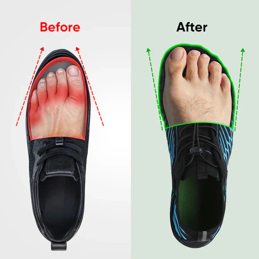 SKYE™ NON-SLIP BAREFOOT SHOES FOR NATURAL COMFORT (UNISEX) - Image 11